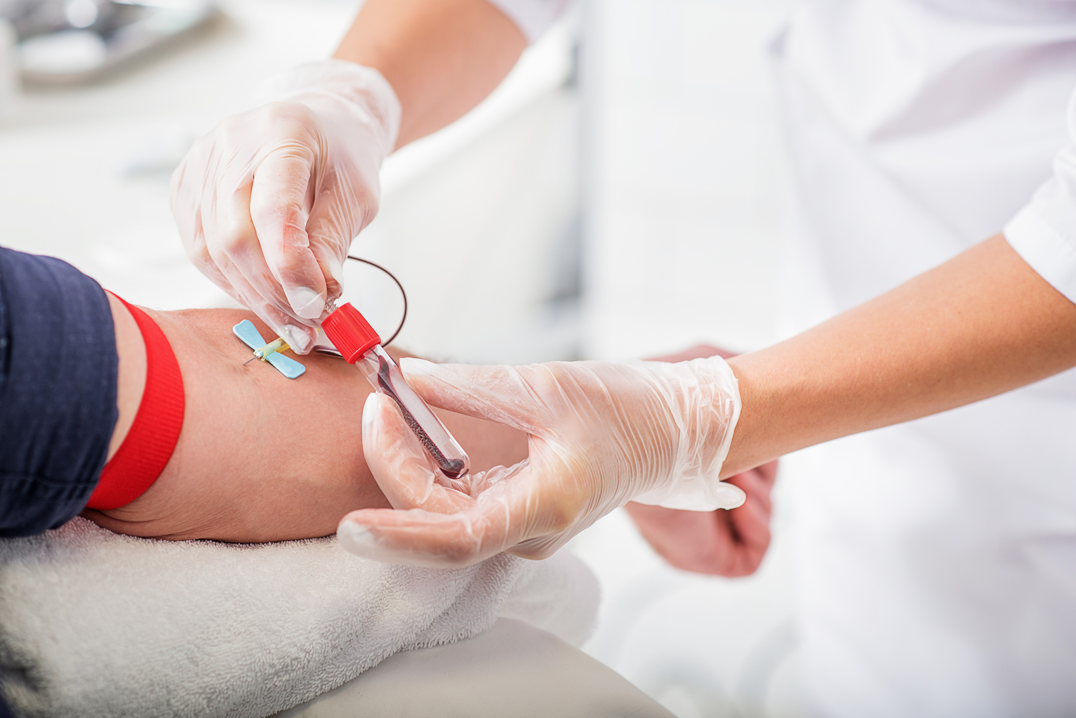 Exame de gravidez de sangue: o que é o Beta hCG? - Hilab