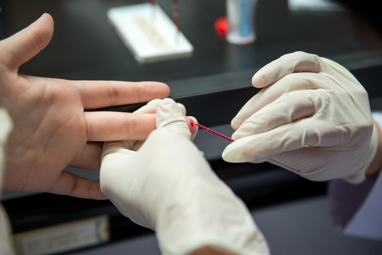 Coleta para teste rápido de HIV em farmácia