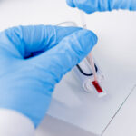Detecção de anticorpos IgG e IgM com exame de sorologia