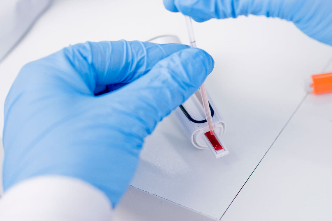 Detecção de anticorpos IgG e IgM com exame de sorologia