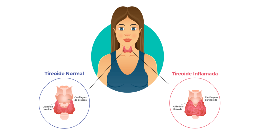 9 fatores que desregulam a menstruação - Minha Vida