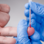 Coleta de sangue para exame de ferritina