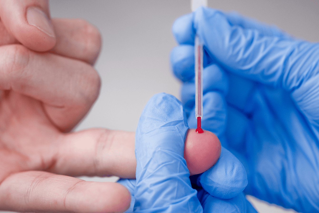 Coleta de sangue para exame de ferritina