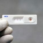 Exame Anti-HCV point-of-care com resultado positivo