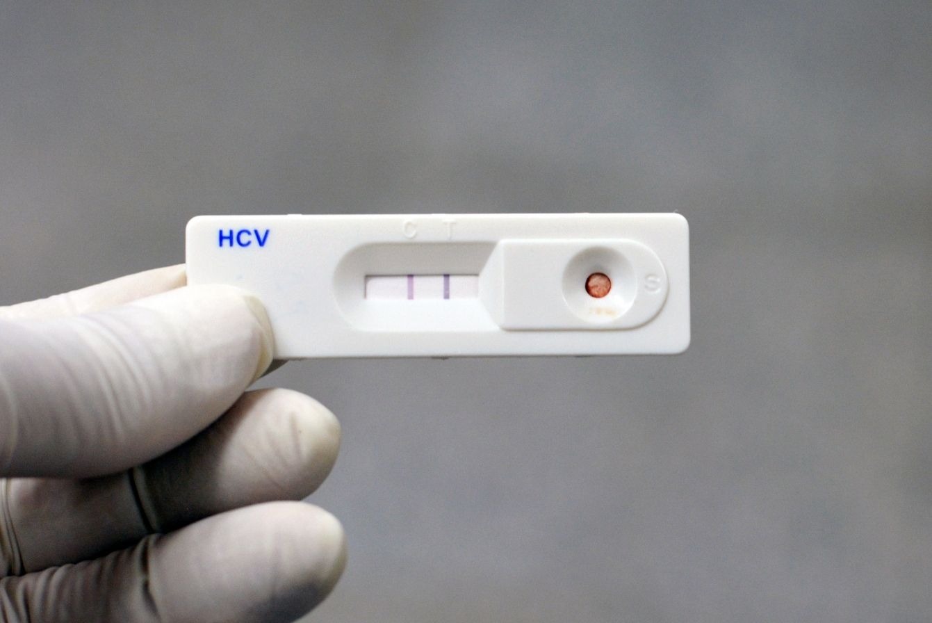 Exame Anti-HCV point-of-care com resultado positivo